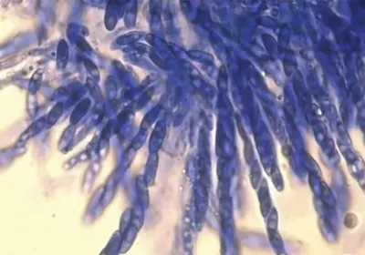 Spores of Fusarium xylarioides
